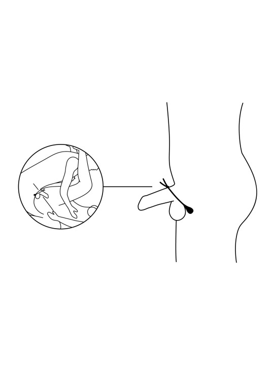 Nexus - Forge Vibrerende Lasso Cockring
